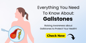 Gallstone Removal in panchkula