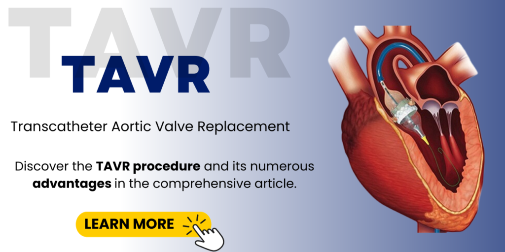 Importance of TAVR as a Minimally Invasive Surgery