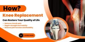How Knee Replacement Surgery Can Restore Your Quality of Life