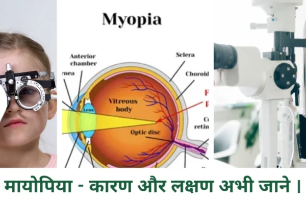 मायोपिया - कारण और लक्षण