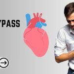 What Are the Success Rates of Heart Bypass Surgery?