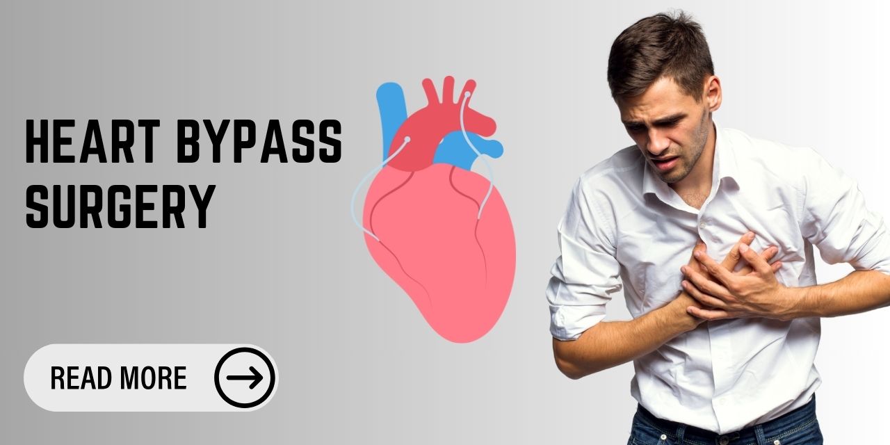 What Are the Success Rates of Heart Bypass Surgery?