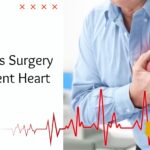 How Effective Is Coronary Artery Bypass Surgery in Preventing Heart Attacks?