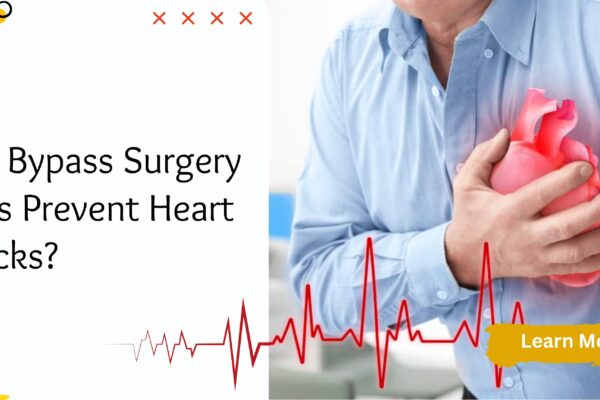 How Effective Is Coronary Artery Bypass Surgery in Preventing Heart Attacks?