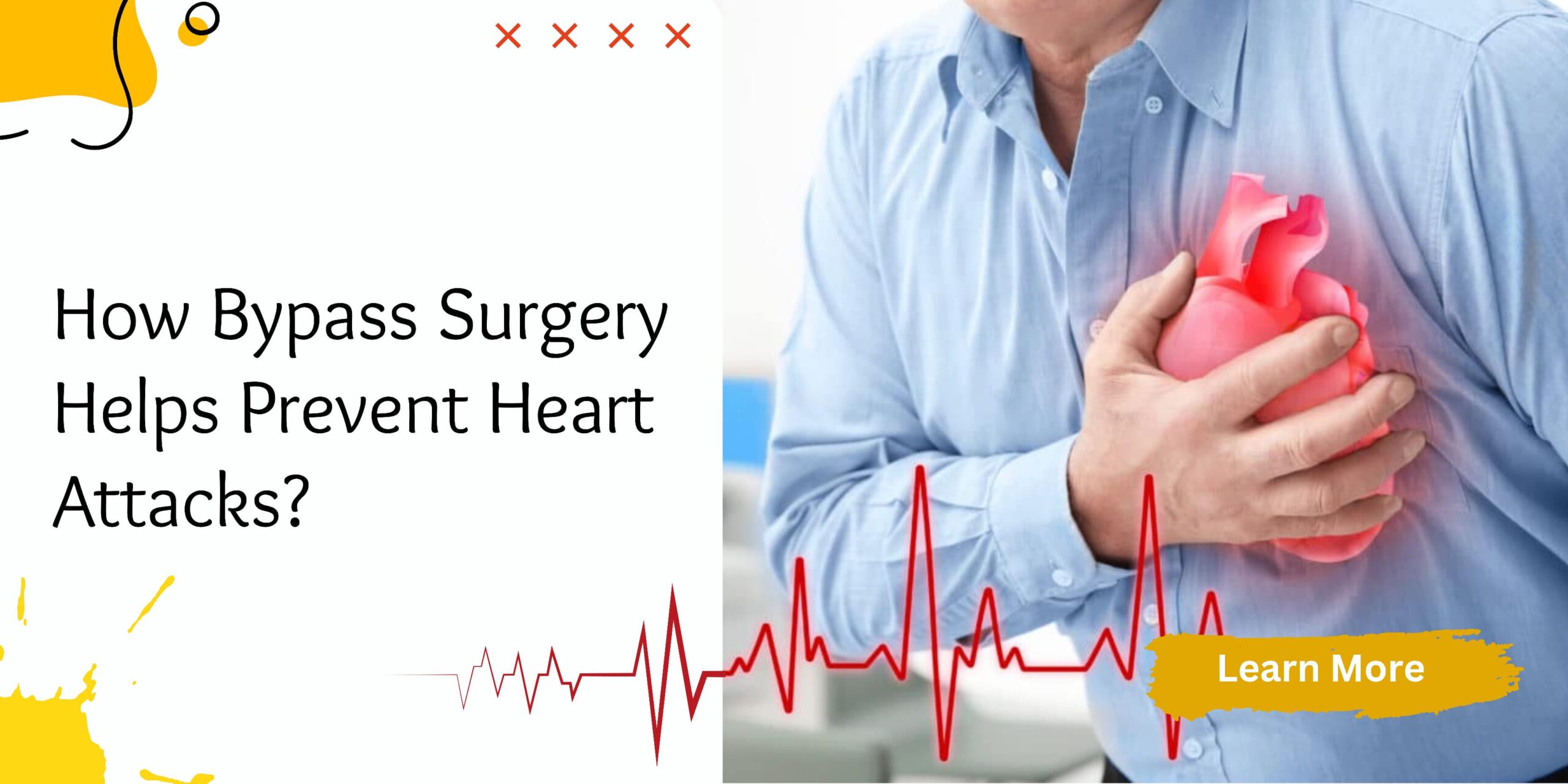 How Effective Is Coronary Artery Bypass Surgery in Preventing Heart Attacks?