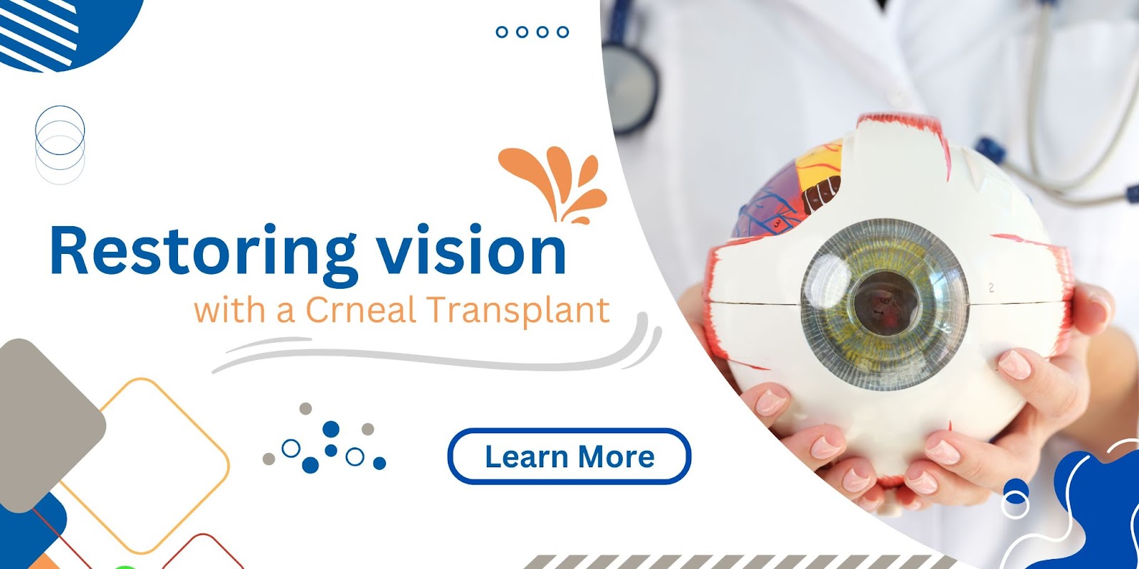 Restoring vision using a corneal transplant