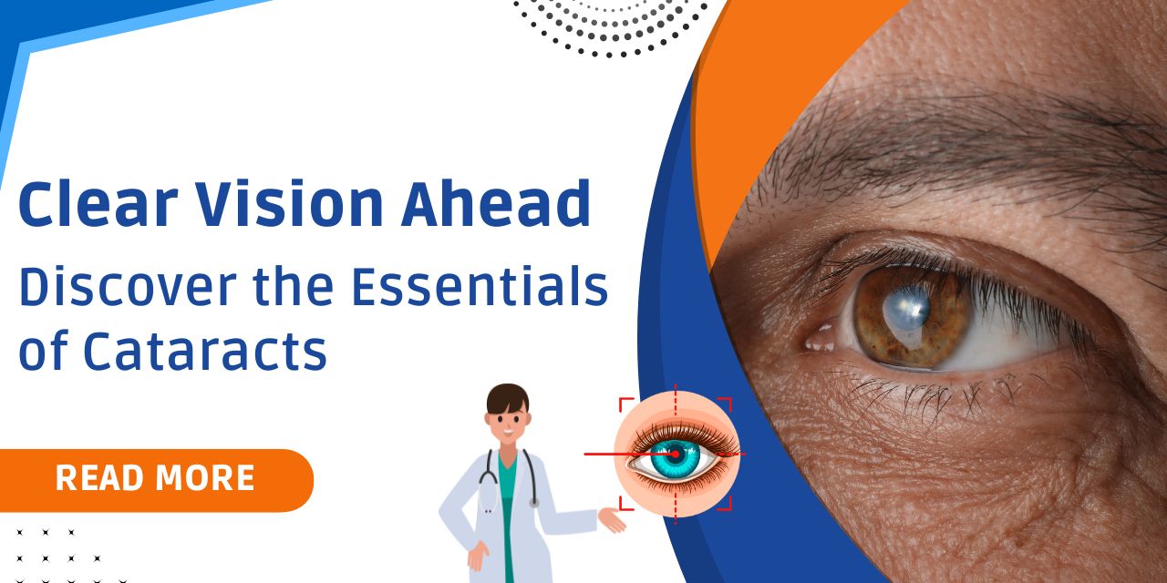 Understanding Cataracts: Causes, Symptoms, and Treatments