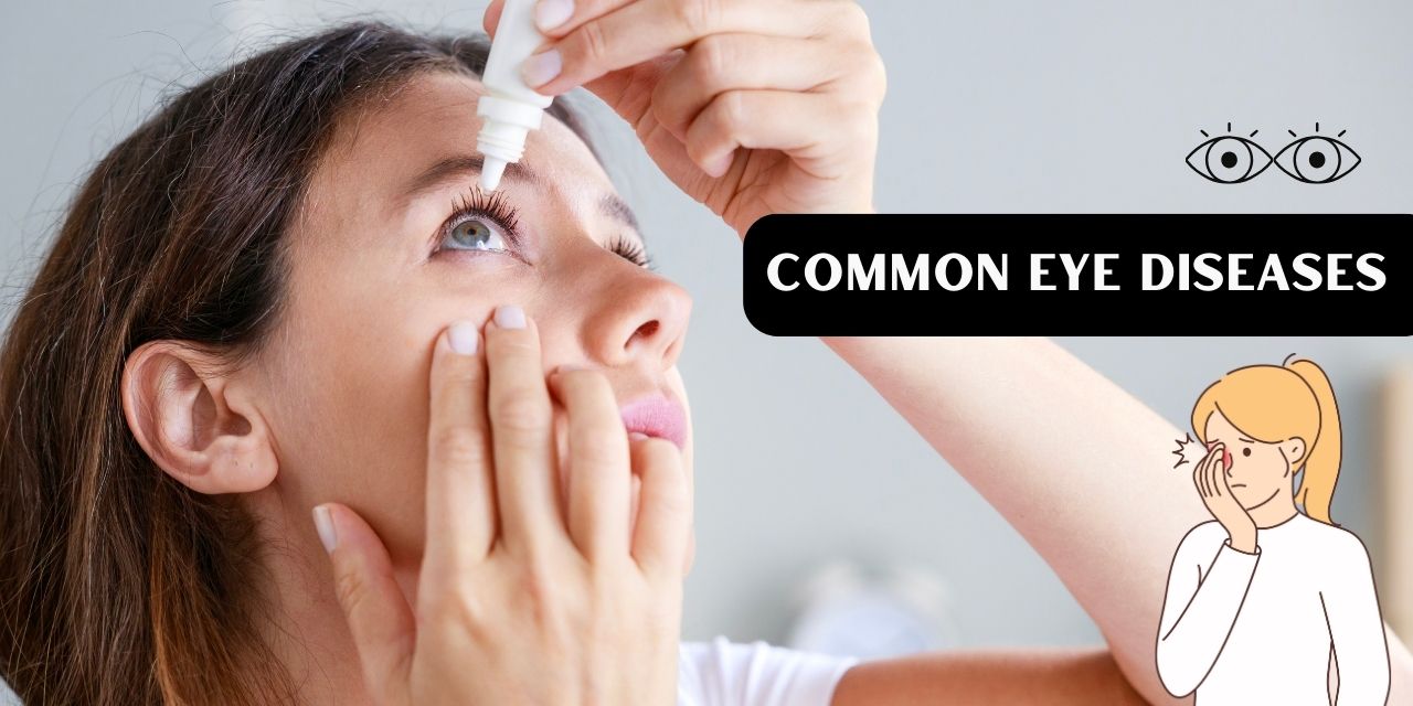 Common Eye Diseases and Disorders: Symptoms, Causes, and Treatments