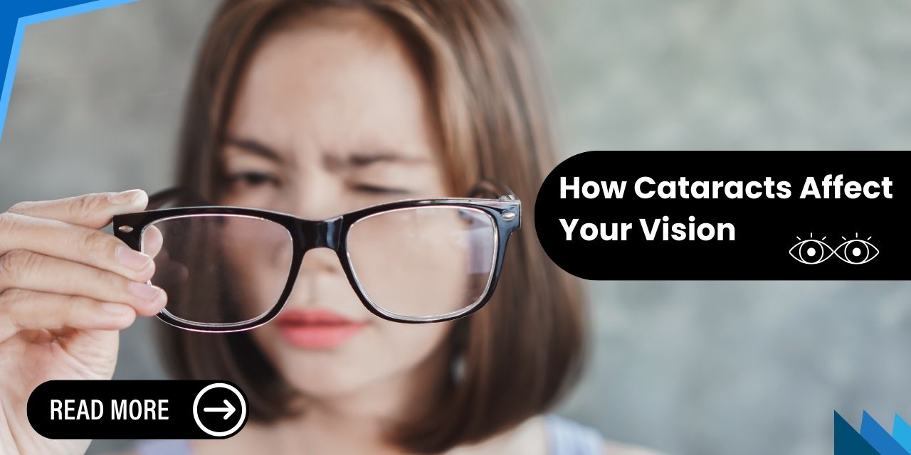 The Blur of Life: How Cataracts Affect Your Vision and Wellness