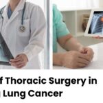 The Role of Thoracic Surgery in Managing Lung Cancer