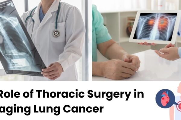 The Role of Thoracic Surgery in Managing Lung Cancer