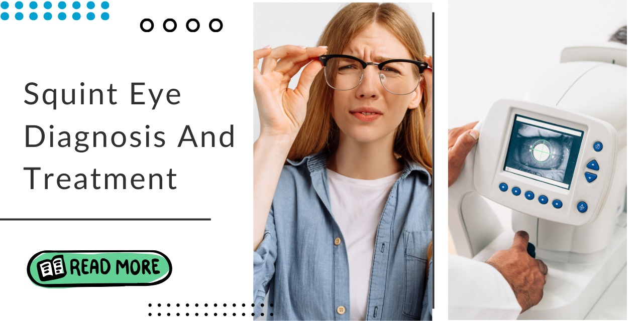 What You Should Know About Eye Squint Diagnosis and Treatment