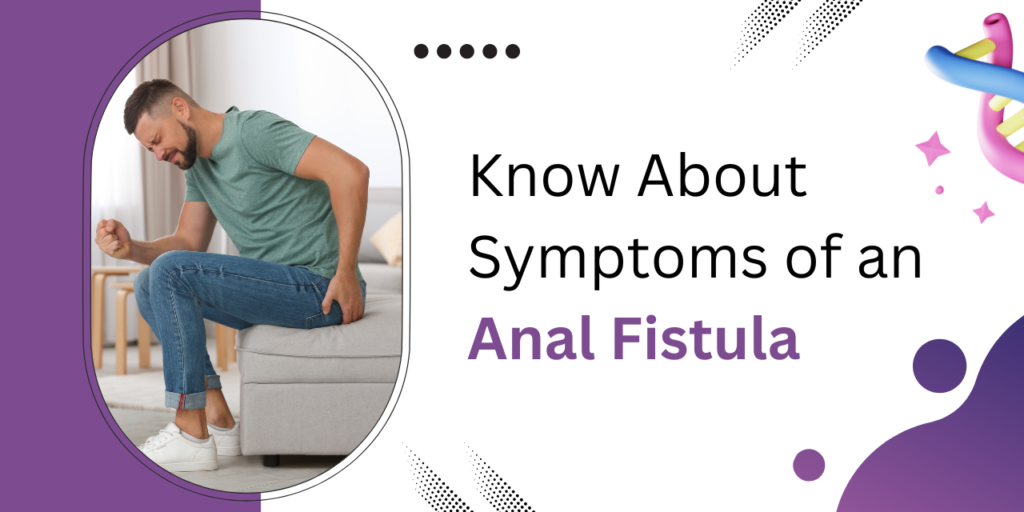 Symptoms of Anal Fistula