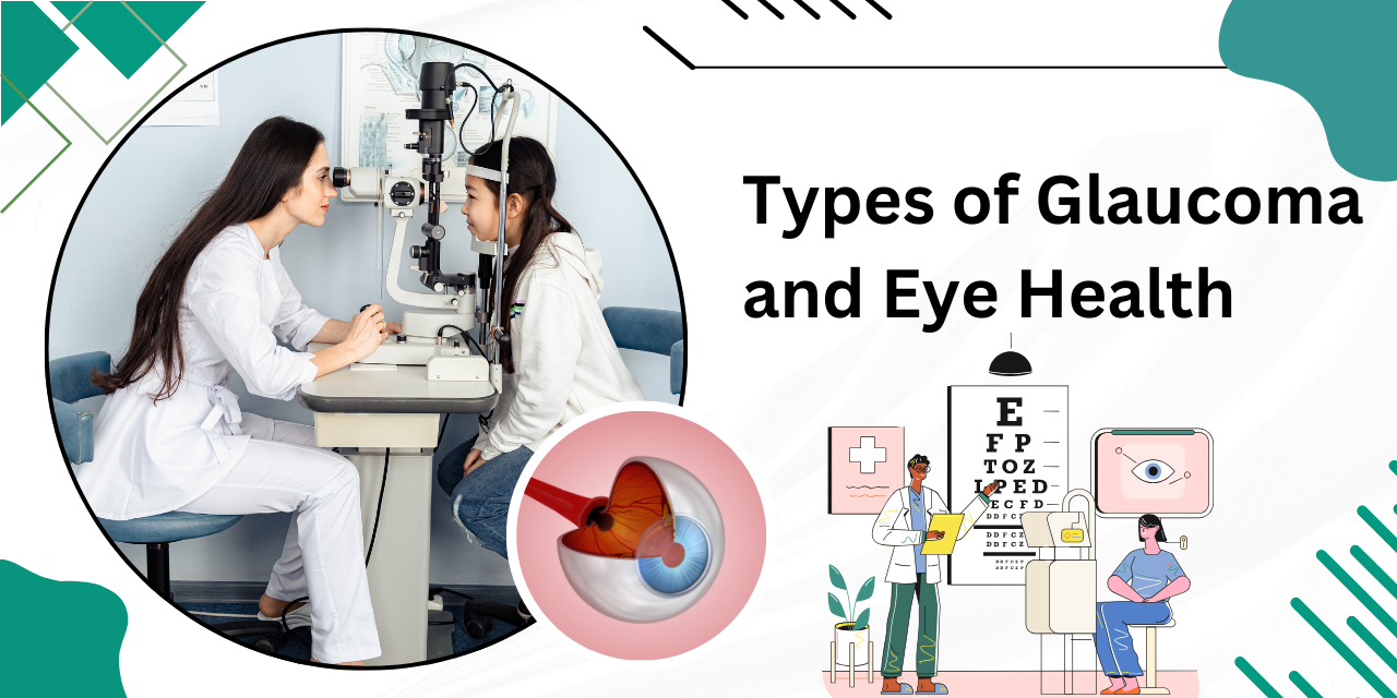 What Are the Different Types of Glaucoma, and How Do They Affect Eye Health?