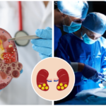 Kidney Stones Treatment