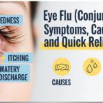 Eye flu symptoms