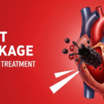 Heart Blockage Symptoms & Treatment