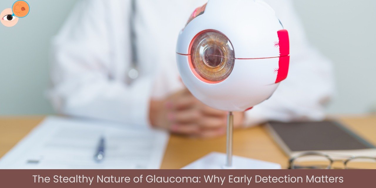 "Close-up of an eye with glaucoma, highlighting vision loss risk and the importance of early detection for eye health.